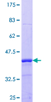 ab162149 on a 12.5% SDS-PAGE stained with Coomassie Blue.