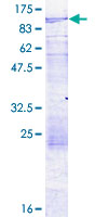 ab160645 on a 12.5% SDS-PAGE stained with Coomassie Blue.