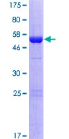 ab161351 on a 12.5% SDS-PAGE stained with Coomassie Blue.
