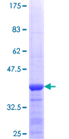 ab161352 on a 12.5% SDS-PAGE stained with Coomassie Blue.