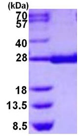 15% SDS-PAGE analysis of 3 µg of ab126698 (Prostaglandin D Synthase (hematopoietic) protein).