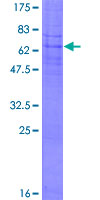 ab159273 on a 12.5% SDS-PAGE stained with Coomassie Blue.
