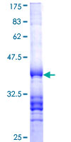 ab152638 on a 12.5% SDS-PAGE stained with Coomassie Blue.