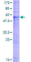 ab159276 on a 12.5% SDS-PAGE stained with Coomassie Blue.
