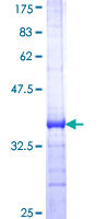 12.5% SDS-PAGE Stained with Coomassie Blue showing ab114757 at approximately 35.64kDa.