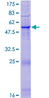 12.5% SDS-PAGE Stained with Coomassie Blue showing ab131953.