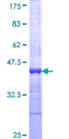ab153325 on a 12.5% SDS-PAGE stained with Coomassie Blue.