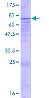 ab159166 on a 12.5% SDS-PAGE stained with Coomassie Blue.