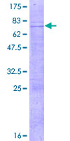 ab164688 on a 12.5% SDS-PAGE stained with Coomassie Blue.