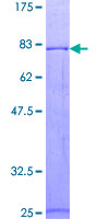 ab159228 on a 12.5% SDS-PAGE stained with Coomassie Blue.