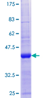 ab166032 on a 12.5% SDS-PAGE stained with Coomassie Blue.