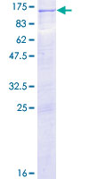 ab153249 on a 12.5% SDS-PAGE stained with Coomassie Blue.