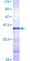 ab153250 on a 12.5% SDS-PAGE stained with Coomassie Blue.