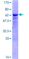ab164858 on a 12.5% SDS-PAGE stained with Coomassie Blue.