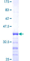 ab114836 analysed on a 12.5% SDS-PAGE gel stained with Coomassie Blue.