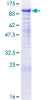 ab159230 on a 12.5% SDS-PAGE stained with Coomassie Blue.