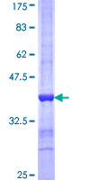 ab159231 on a 12.5% SDS-PAGE stained with Coomassie Blue.