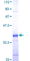 ab160289 on a 12.5% SDS-PAGE stained with Coomassie Blue.