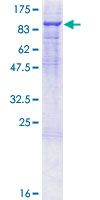 ab158398 on a 12.5% SDS-PAGE stained with Coomassie Blue.
