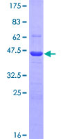 ab158399 on a 12.5% SDS-PAGE stained with Coomassie Blue.