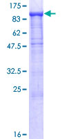 ab164895 on a 12.5% SDS-PAGE stained with Coomassie Blue.