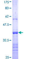 ab164896 on a 12.5% SDS-PAGE stained with Coomassie Blue.