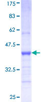 ab163327 on a 12.5% SDS-PAGE stained with Coomassie Blue.