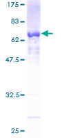 ab160099 on a 12.5% SDS-PAGE stained with Coomassie Blue.