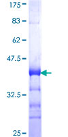 ab160349 on a 12.5% SDS-PAGE stained with Coomassie Blue.