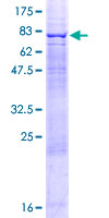 ab160348 on a 12.5% SDS-PAGE stained with Coomassie Blue.