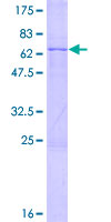 ab153102 on a 12.5% SDS-PAGE stained with Coomassie Blue.