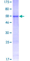 ab164985 on a 12.5% SDS-PAGE stained with Coomassie Blue.