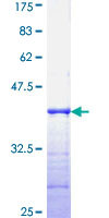 ab164986 on a 12.5% SDS-PAGE stained with Coomassie Blue.