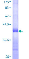 ab159233 on a 12.5% SDS-PAGE stained with Coomassie Blue.