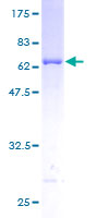 ab159234 on a 12.5% SDS-PAGE stained with Coomassie Blue.