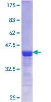 ab159235 on a 12.5% SDS-PAGE stained with Coomassie Blue.