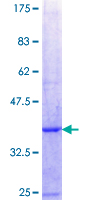 ab159236 on a 12.5% SDS-PAGE stained with Coomassie Blue.