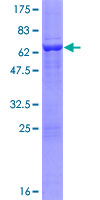 ab159237 on a 12.5% SDS-PAGE stained with Coomassie Blue.