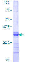 ab159238 on a 12.5% SDS-PAGE stained with Coomassie Blue.