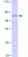ab163213 on a 12.5% SDS-PAGE stained with Coomassie Blue.