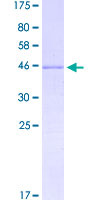 ab162745 on a 12.5% SDS-PAGE stained with Coomassie Blue.