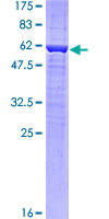 ab162514 on a 12.5% SDS-PAGE stained with Coomassie Blue.