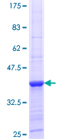 ab165878 on a 12.5% SDS-PAGE stained with Coomassie Blue.