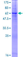 ab161209 on a 12.5% SDS-PAGE stained with Coomassie Blue.