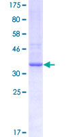 ab161210 on a 12.5% SDS-PAGE stained with Coomassie Blue.