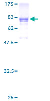 ab153466 on a 12.5% SDS-PAGE stained with Coomassie Blue.
