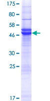 ab165701 on a 12.5% SDS-PAGE stained with Coomassie Blue.