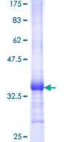 ab159927 on a 12.5% SDS-PAGE stained with Coomassie Blue.