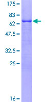 ab162089 on a 12.5% SDS-PAGE stained with Coomassie Blue.