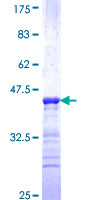 ab162090 on a 12.5% SDS-PAGE stained with Coomassie Blue.